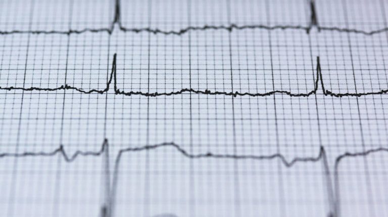 Affordable Heart Attack Treatment in Jaipur Heart attack treatment Advanced heart treatment heart failure treatment Jaipur emergency Heart Care